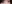 二重まぶた（自然癒着法） — ルホ美容外科クリニック