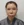 ศัลยกรรมยกริมฝีปากบน (Lip Lift) — ก่อนทำ (7วัน) · คลินิกความงามมิอินโด-สาขากังนัม