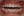จัดฟันเฉพาะส่วนด้านใน 2D (2D lingual partial braces) — ก่อนทำ (120วัน) · โรงพยาบาล ID - ทันตกรรม