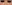 裏ハムラ法（経結膜的眼窩脂肪移動術） — オブジェ美容外科クリニック