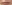 唇のヒアルロン酸注入（リップヒアルロン酸） — セイエスクリニック