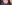 豊胸（脂肪注入） — ソウルアイ美容外科クリニック