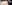 額縮小術（生え際下げ・ヘアライン下降術） — コウユ美容外科クリニック