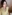 小鼻縮小術 — エックスオー美容外科クリニック