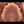 MTA orthodontics (Mini-Tube Appliance partial braces) — before (90days) · Make Dental Clinic