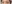 二重まぶた（自然癒着法） — ルホ美容外科クリニック