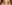 眼瞼下垂手術（目つき矯正） — ジュエリー美容外科クリニック