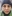 InMode lifting (InMode Lift — bipolar RF skin tightening) — Better Me Clinic - Gangnam