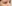 裏ハムラ法（経結膜的眼窩脂肪移動術） — ジャスト美容外科クリニック