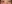 裏ハムラ法（経結膜的眼窩脂肪移動術） — ファクト美容外科クリニック