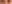 裏ハムラ法（経結膜的眼窩脂肪移動術） — ファクト美容外科クリニック