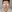 revision rhinoplasty — Anersty Plastic Surgery Clinic