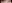 二重まぶた（自然癒着法） — イエロー美容外科クリニック