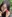 二重あごの脂肪吸引（顎下脂肪吸引） — ジェリム美容外科クリニック