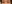 Ptosis Correction (levator surgery / eye-shape correction) — Planner Plastic Surgery Clinic