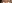 眉毛挙上術（ブロウリフト） — エイペックス美容外科クリニック