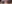 二重まぶた（自然癒着法） — プロミス美容外科クリニック