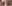 Brow lift — Urban Plastic Surgery Clinic