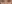 裏ハムラ法（経結膜的眼窩脂肪移動術） — オブジェ美容外科クリニック