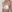 副乳の脂肪吸引 — エイト美容外科クリニック