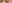 二重まぶた（自然癒着法） — ルホ美容外科クリニック