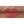 Thread lift — after · Erne Clinic