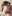 輪郭形成の修正手術（再手術） — エックスオー美容外科クリニック