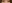 眼瞼下垂手術（目つき矯正） — Unique Plastic Surgery Clinic
