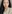 Nasal osteotomy (nasal bone narrowing) — RU Plastic Surgery Clinic