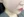 รีจูราน (Rejuran) — หลังทำ · เมซงเดอม์คลินิก