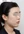 two-jaw surgery (bimaxillary orthognathic surgery) — before (90days) · A-Top Plastic Surgery Clinic