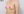 豊胸術（シリコンインプラント／人工乳腺） — 術前 (14日) · 新しい美容外科クリニック