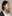 頬骨縮小術（全体／頬骨体部＋頬骨弓の骨切り） — エックスオー美容外科クリニック