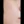 skin booster injection (water glow injection) — after (7days) · A-Top Plastic Surgery Clinic
