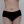 Back liposuction — after (13days) · Hourglass Clinic