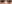 裏ハムラ法（経結膜的眼窩脂肪移動術） — アイフィット美容外科クリニック