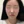 麗珠蘭（Rejuran Healer） — 術後 · Skinic醫美診所