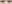 裏ハムラ法（経結膜的眼窩脂肪移動術） — ファクト美容外科クリニック