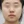 ฉีดสลายไขมันหน้า (เมโสแฟตแก้ม) — ก่อนทำ · เจย์ฟิล คลินิก - สาขาริมแม่น้ำ