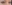 二重まぶた（自然癒着法） — ルホ美容外科クリニック