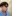 Bulbous nose correction (surgical nasal tip reduction) — Uri Plastic Surgery Clinic