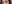 眼瞼下垂手術（目つき矯正） — アイエムケー(IMK)美容外科クリニック