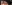 涙袋ヒアルロン酸注入（涙袋形成） — A-Top美容外科クリニック