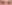 埋没法（二重埋没法） — ルホ美容外科クリニック