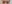 二重まぶた（自然癒着法） — ルホ美容外科クリニック
