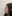 Bulbous nose correction (surgical nasal tip reduction) — Eight Plastic Surgery Clinic