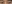 眼瞼下垂手術（目つき矯正） — カスタム美容外科クリニック