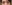 眼瞼下垂手術（目つき矯正） — ザ・プラス美容外科クリニック