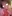 小鼻縮小術 — エックスオー美容外科クリニック