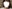 頬骨縮小術（全体／頬骨体部＋頬骨弓の骨切り） — BN Plastic Surgery Clinic